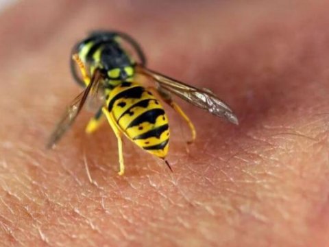 Arı sancan gəncə iynə vurulmayıb - AÇIQLAMA