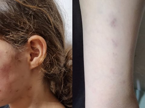 Prokurorluq başçı müavininin şagirdi döyməsi iddiasını ARAŞDIRIR