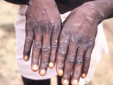 Meymunçiçəyindən daha bir ölüm