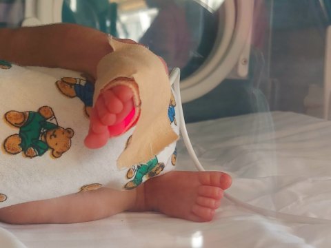 Quba Perinatal Mərkəzdə 10 uşaq ölüb