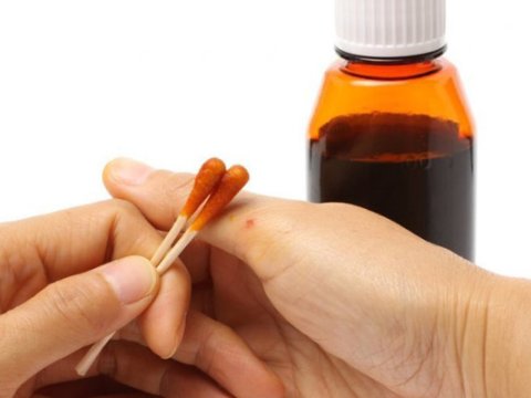 “Nüvə silahı atılsa, əllərdəki yod Fatıya tuman olmayacaq” - Bakıda yod çatışmazlığı  