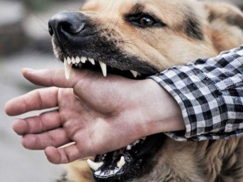 3 ayda 321 nəfəri it DİŞLƏYİB