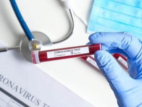 Dünyanın koronavirus MƏNZƏRƏSİ: milyonlarla insan...