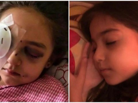 İranda polis atəş açdı - 6 yaşlı qız gözünü itirdi