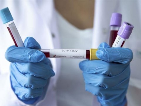 Azərbaycanın koronavirus statistikası - Ölən yoxdur 