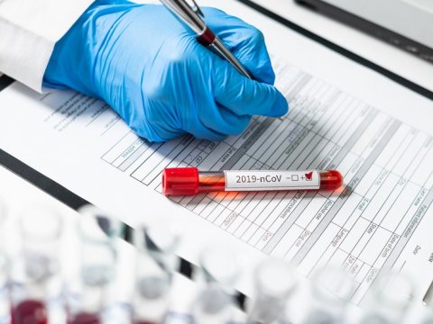 Operativ Qərargahdan koronavirus AÇIQLAMASI