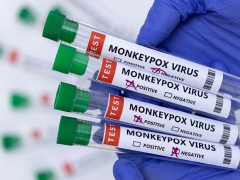 Ölkəmizə yeni virusu aşkar edən testlər gətirildi