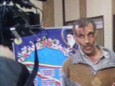 Səfirliyimizə hücum edən terrorçunun FOTOSU