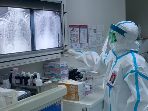 Yoluxma azalsa da, 4 nəfər öldü