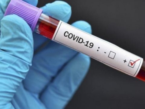 Daha 39 nəfər COVID-19-a yoluxdu, 2-si öldü
