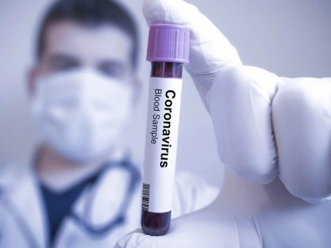 Azərbaycanda koronavirusa yoluxma 3 dəfə AZALIB