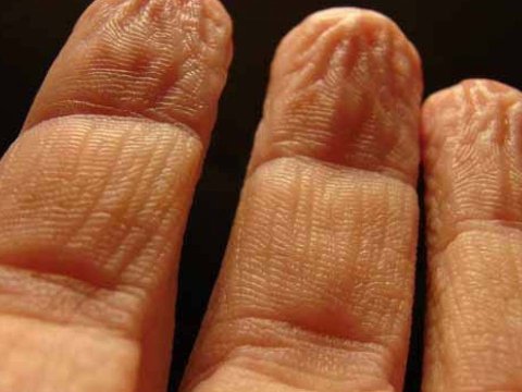 Barmaqların qırışması nədən xəbər verir?