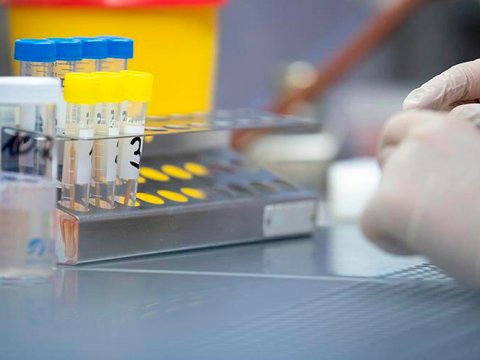 Pakistanda meymunçiçəyinə ilk yoluxma aşkarlandı