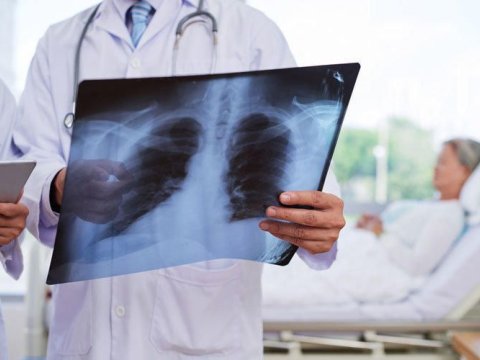 Rentgenə gedənlərin nəzərinə - Diqqəli olun!