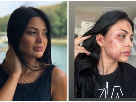 Modeli döyən sevgilisi HƏBS EDİLDİ 