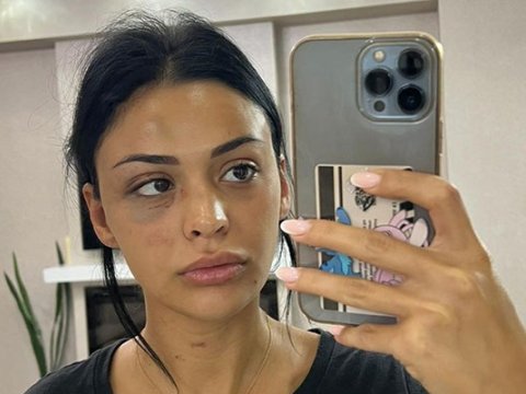 Sevgilisi tərəfindən döyülən model: Bıçaqla işgəncə verirdi