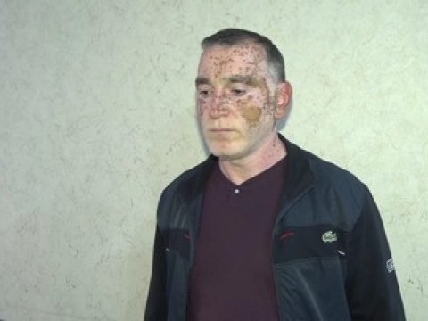 Çətənə yetişdirən qohumlar SAXLANILDI