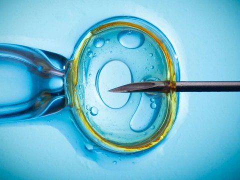 Süni mayalanmadan doğulan uşaqlar - Hər ay 300-dən çox...