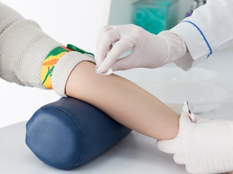 İldə iki dəfə İİV müayinəsindən keçmək lazımdır 