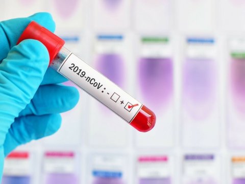 Daha 11 nəfər yoluxdu - Ölən yoxdur