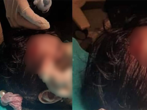 Azyaşlı qızı skuter vurdu 