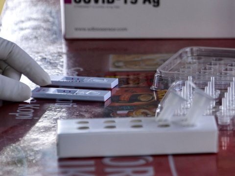 Koronavirusdan ölənlərin sayı 61% AZALIB