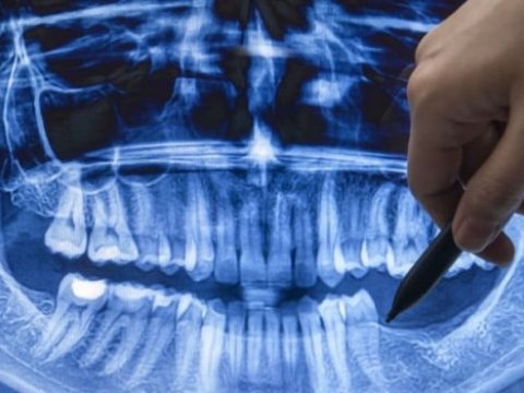 Yeni diş çıxaran dərman İCAD EDİLDİ