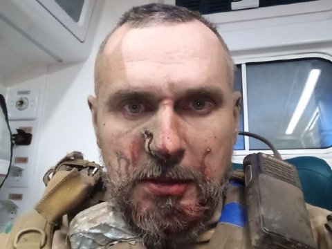 Tanınmış rejissor yenidən döyüşdə yaralandı