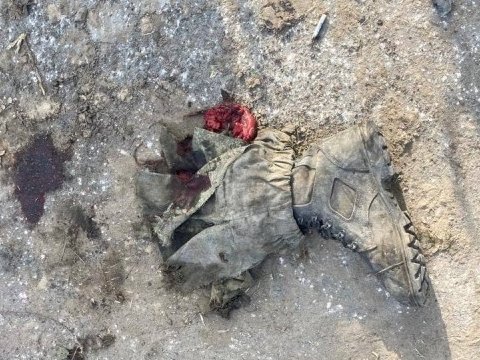 Rusiyanın müharibə itkiləri - Daha 460 hərbçi ölüb