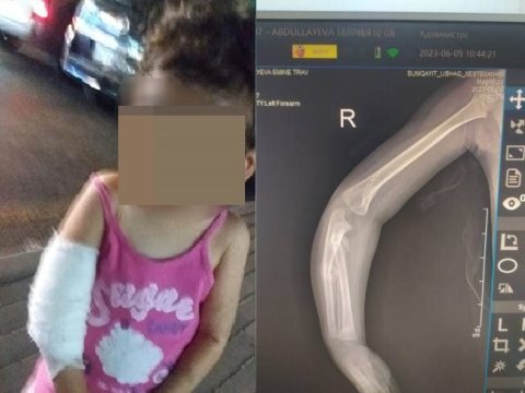 Nənə 2 yaşlı nəvəsinə işgəncə veribmiş...