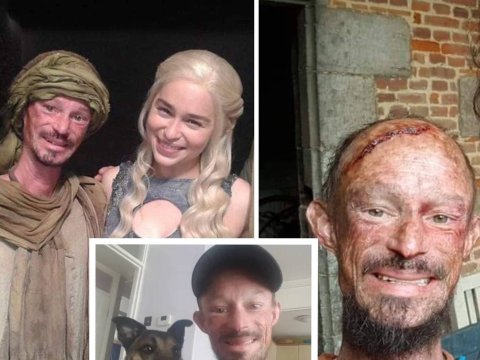 “Game of Thrones”un aktyoru vəfat etdi