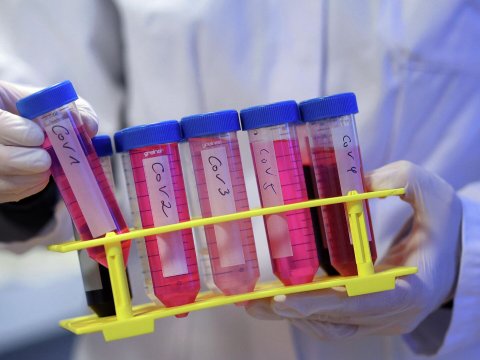 Gürcüstanda koronavirusun yeni növü yayılır