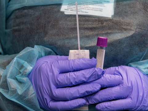 Yeni koronavirus dalğası... - Yoluxma sayı 63% artıb