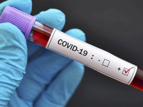 COVID-19-un yeni və daha çox yoluxucu olan ştam tapıldı