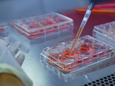 Xərçəng xəstəliyi üçün yeni bioloji preparat yaradıldı