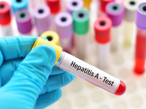 Regionlarda hepatit A virusuna yoluxma müşahidə edilir - TƏBİB