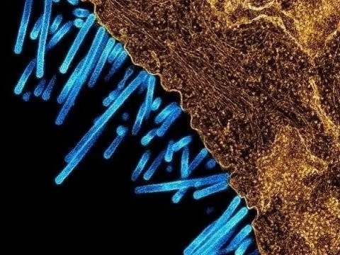 Britaniyada donuz qripi - İlk dəfə aşkarlandı