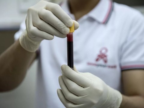 Hər dəqiqədə 1 nəfəri öldürən xəstəlik: Ölkəmizdə vəziyyət necədir?