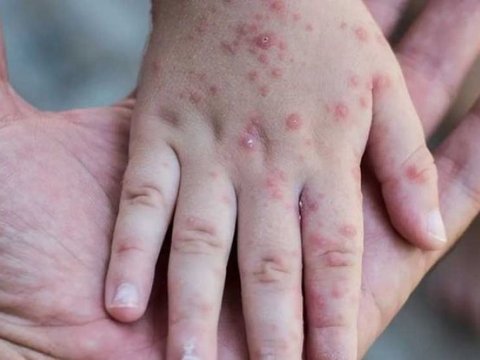 Qızılcadan ölən 3 yaşlı Rüfətin atası: Oğlum bağçadan başqa heç yerə getmirdi - FOTO