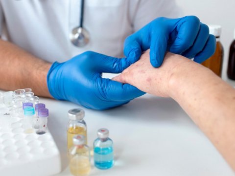 TƏBİB-dən qızılca ilə bağlı çağırış: Evdə müalicə etməyin!