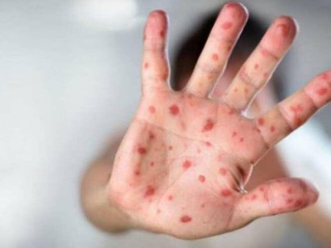 Lənkəranda azyaşlı qızılcadan ÖLDÜ