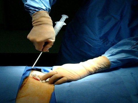 Yeni Klinikada sümük iliyi transplantasiyası həyata keçiriləcək