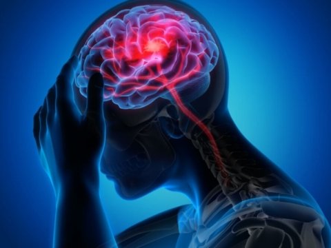 Alimlər insultun müalicəsi üçün tədqiqat apardılar