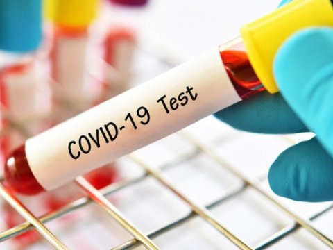 Azərbaycanda COVID-19-un yeni ştamı yayılıb? - Nazirlikdən açıqlama