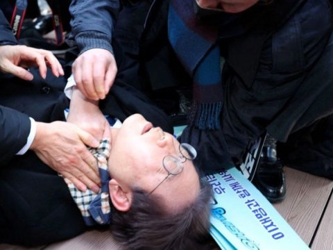 Hücuma məruz qalan müxalifət lideri əməliyyat olunacaq