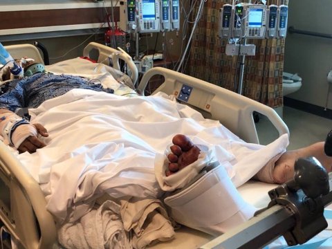 Partlayışda xəsarət alan 9 nəfərin vəziyyəti ağırdır - TƏBİB