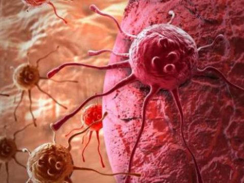 Xərçəng xəstələrinin sayı sürətlə artacaq - Alimlərdən XƏBƏRDARLIQ