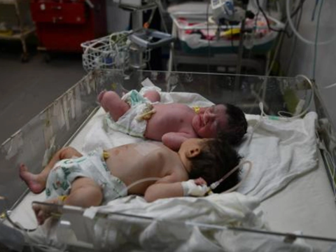 Qəzzada körpələr aclıqdan ÖLDÜ