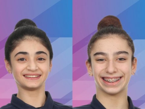 İdmançılarımız Almaniyada 2 medal qazandı