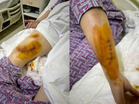 Bakıda ukraynalı qadını əri BIÇAQLADI